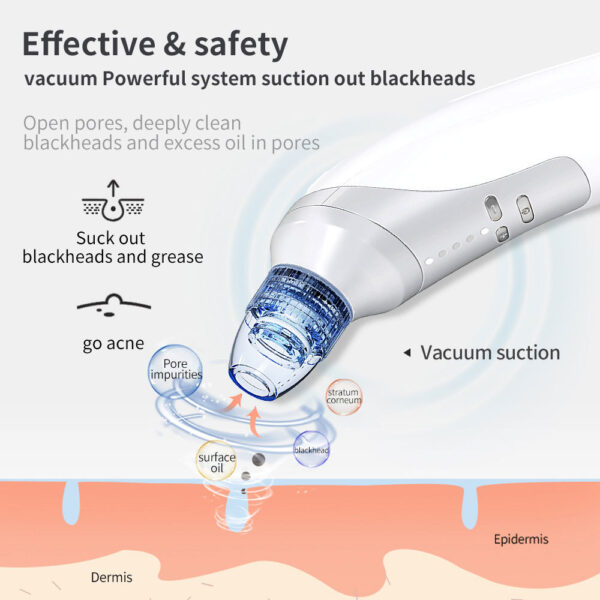 Electric Blackhead Suction Instrument – At-Home Acne & Pore Cleaner - Image 5