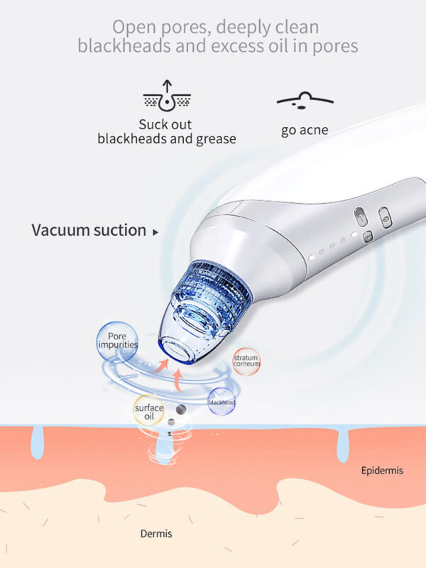 Electric Blackhead Suction Instrument – At-Home Acne & Pore Cleaner - Image 4